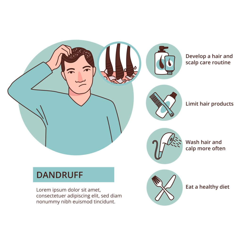 Side Effects of Minoxidil 
